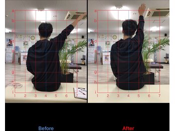 ストレチックス 近江八幡店/BeforeAfter