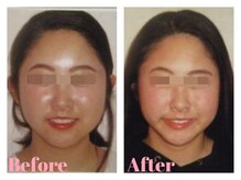 ドクター ヴィーナス/