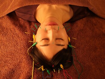 ジーブ(jeebu)/女性人気No.1★美容鍼