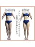 【全身筋膜痩身90分】 ハイパーナイフEX＆シェイプ脂肪燃焼