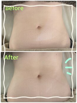 ラルゴ(Largo)/リンパケアでサイズダウン♪