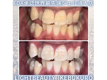 ライトビューティー 池袋店(LightBeauty)/症例写真