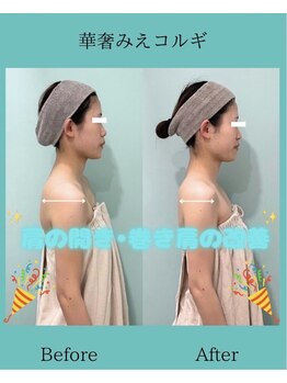 アコガレコガオ 鳥取店/コルギのビフォーアフター