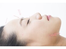 リュウ鍼灸院 サロン ド リュウ(Salon de Ryu)