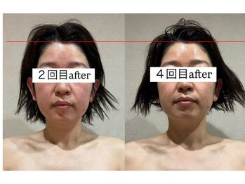 シェリーナ(cherieNa)/見た目から変わる