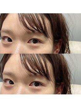 バルム(Balm)/ラッシュリフト