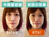 【切らない中顔面短縮】大好評メニューの中顔面を短縮する美顔デザイン構築術