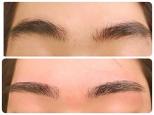 トータルビューティ ノイド(Noid)/メンズ美眉WAX脱毛