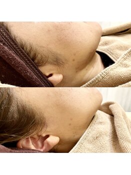 シック(Chic)/マリムーブフェイシャルワックス