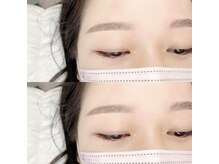 バベル 京橋店(Babel)/アイブロウwax脱毛