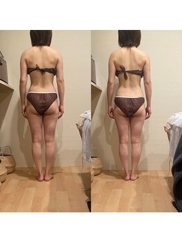 トトノエル(TOTONOEL)/肩甲骨×下半身筋膜リリース