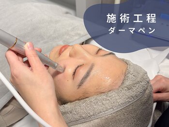 ベル 渋谷(belle)/エステダーマ施術工程