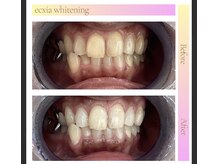 エクシアホワイト 平岸駅前店/