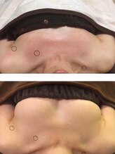 ラディス(Radice.)