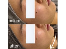 ベール(BEHL)/コルギ＋石膏のBefore After