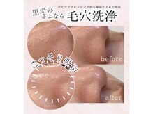 毛穴ケアやあらゆる肌悩みにも対応◎