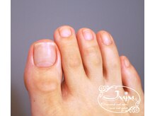 ジュジュ(Juju)/フットケアでつやつやふっくら