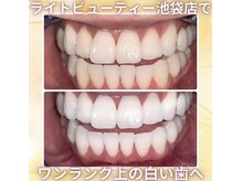 ライトビューティー 池袋店(LightBeauty)/症例写真