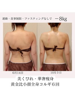 ピーチハート(Peach Heart)/黄金比小顔全身コルギ