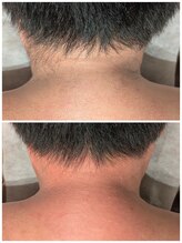 トリニティスペース(TrinitySpace)/メンズもうなじ(襟足)ワックス☆