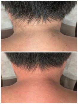 トリニティスペース(TrinitySpace)/メンズもうなじ(襟足)ワックス☆