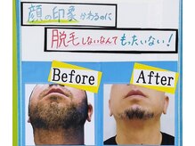 島ちゅ整骨院の雰囲気（院長自ら体験し効果を実感しています☆髭剃り後のヒリヒリ卒業）