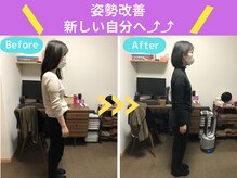 京都中丸整体カイロプラクティック/不良姿勢