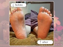 ネクシア 恵比寿(NEXIA EBISU)/フットケアで血行促進＆代謝UP