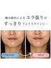 【熊本在住・初回限定】憧れの小顔へ♪お試し美容鍼fot顔幅改善★5,980円　
