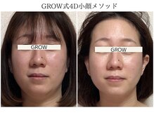 グロウ バイ フェイシャルデザイン アンド アイ(GROW)の雰囲気（40代～のお悩み、たるみケア/ほうれい線/マリオネットライン改善）