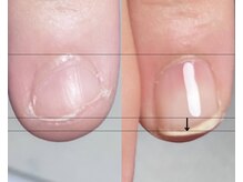 イッポ(ippo)の雰囲気(深爪&自爪育成、初回9,900円育成オイルお渡しします。)