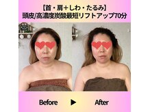 ◇フェイシャルケア◇