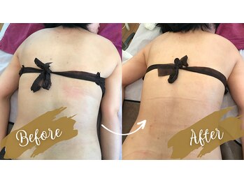 サロンハナ(Salon HANA)/全方位美人☆バストアップコース