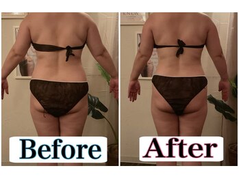 トータルビューティーサロン 凛/食事指導でリバウンドなし