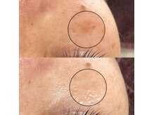 セメ(S'aimer)の雰囲気（リフトアップしながら肌質改善ケア）