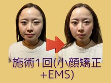 ヴィアス 名古屋高岳店(VIAS)の雰囲気（【ビフォーアフター】フェイスライン、目元）