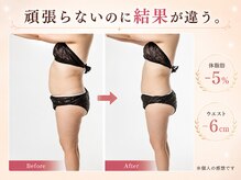 ヨサパーク アカーシャ(YOSA PARK AKASHA)の雰囲気（痩せたい…でも痩せられない…お悩みを解決へと導きます！）