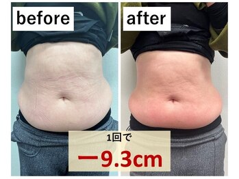 クラティス(CRATIS)/【エルフィーノ】一回でこの結果