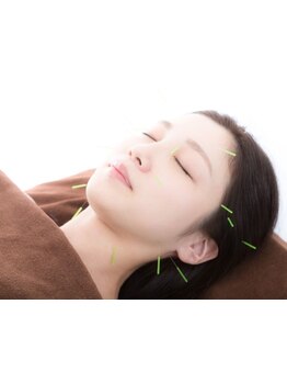 鍼灸施術を受けたい