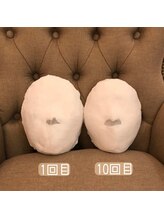 R-1ビューティーサロン 表参道/Before &After（10回）