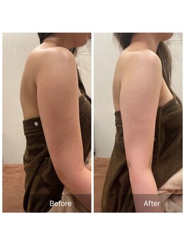 アランチャンティック(AlamCantik)/最強美人バストアップ