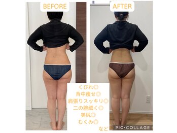 ヨサパーク アプリコット(YOSA PARK)