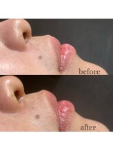 エヌドット バーバーギンザ(N.BARBER GINZA)/顔剃りでトーンup☆