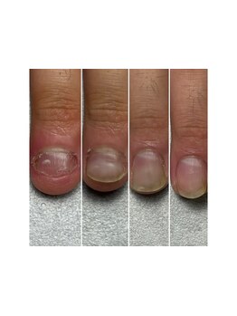 スゴ腕の施術者がいるサロン