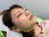 【基本の肌管理＋さらにボディメンテ】美容鍼（60分）