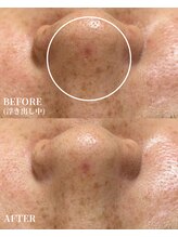 エース(ACE.)/皮脂汚れスッキリ☆