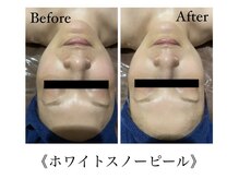 サロンドシェリ(salon de cheri)/ホワイトスノーピール