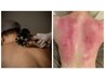 【肩こり解消】脂肪分解・老廃物の排出を促進、揉む、ほぐす、流す！40分◎