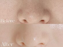 ウィハナ(wehana)の雰囲気（肌質改善サロン）