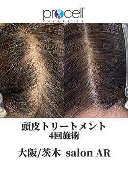 サロン アール(salon AR)/プロセルセラピーズ